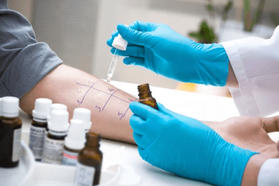 Allergy Testing Cardiff Allergy Testing Cardiff