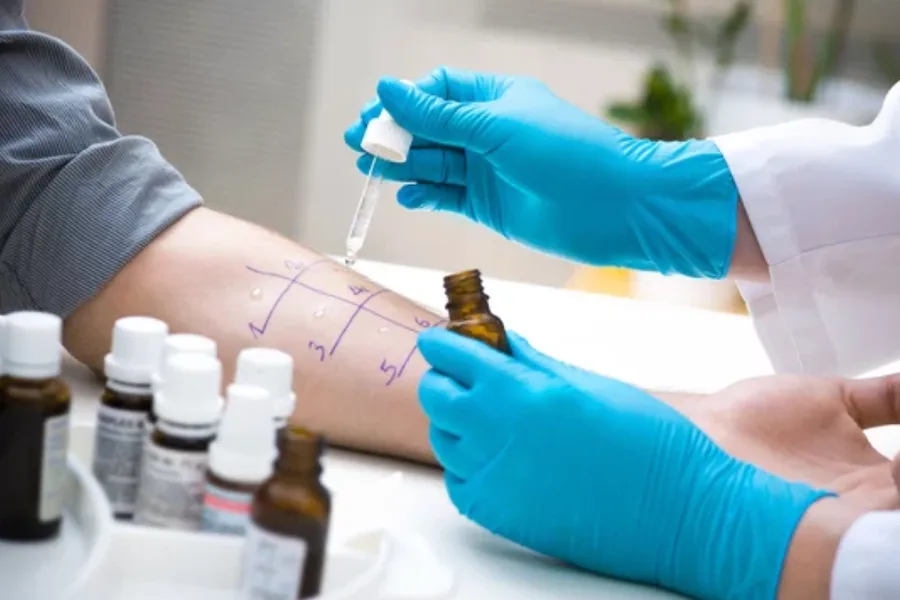 Allergy Testing Cardiff